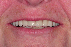Hermon Family Dental 