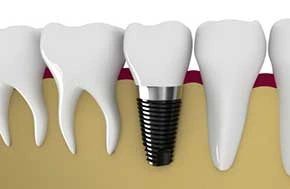 Hermon Family Dental 